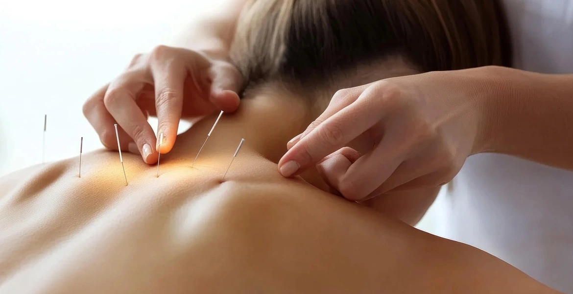 D Acupuncture.webp